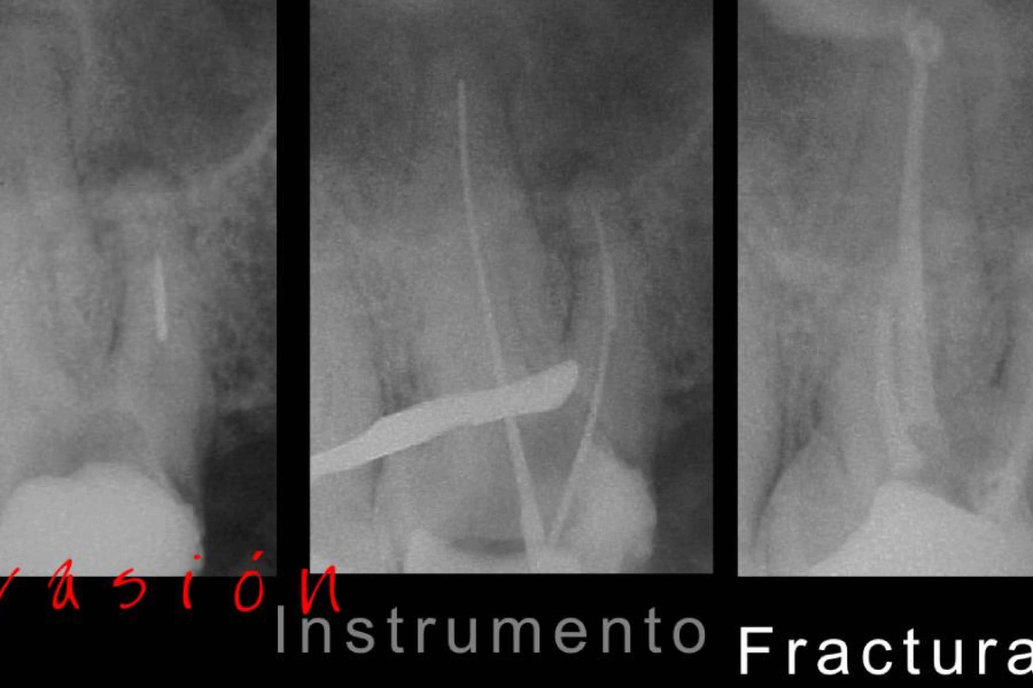 exibid_evasioninstrumen2