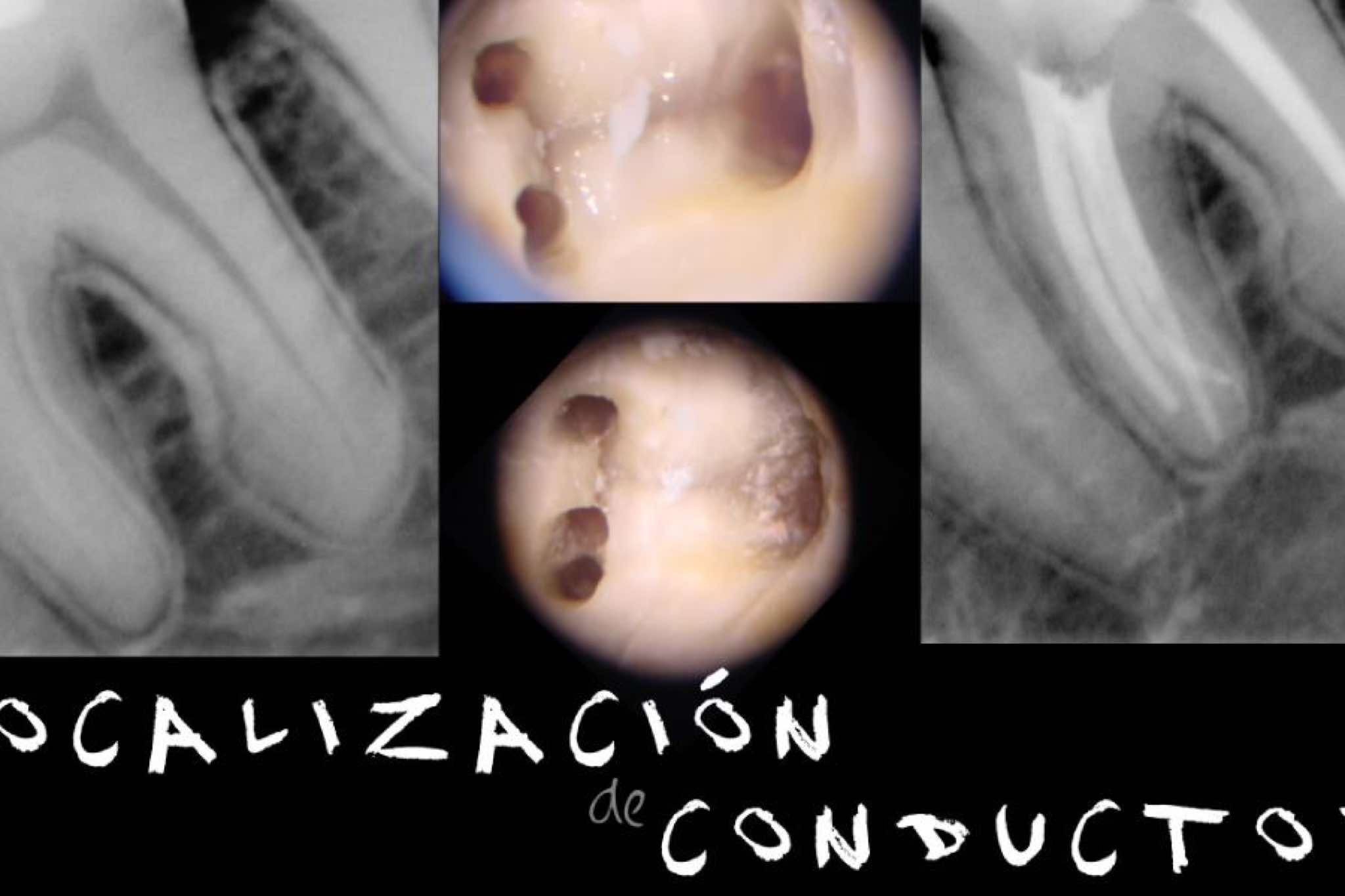 exibid_localizaciondeco2