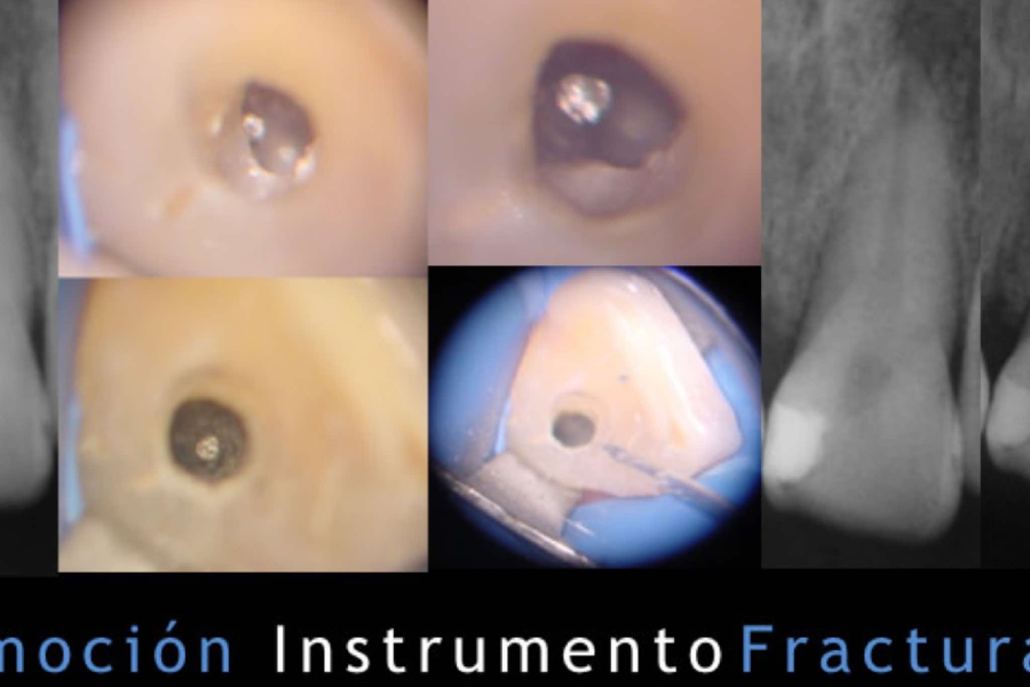 exibid_renocioninstrume2